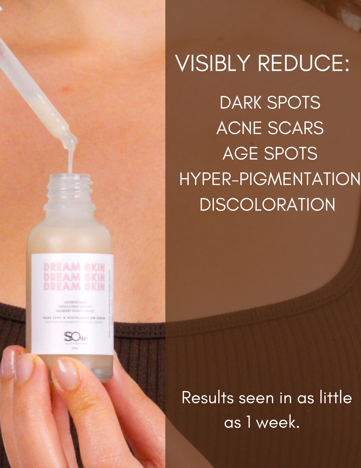 DREAM SKIN Dark Spot & Discoloration Serum