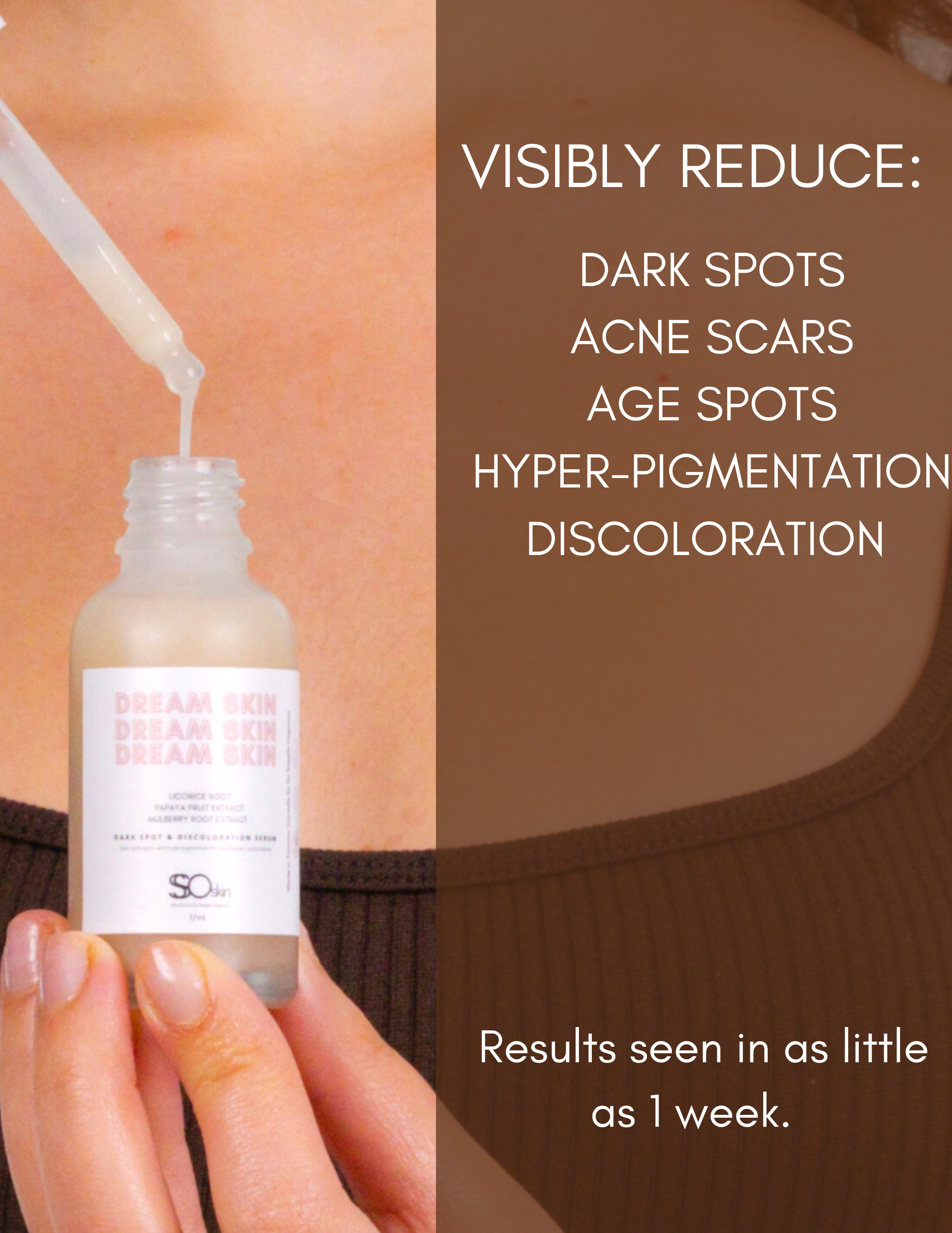 DREAM SKIN Dark Spot & Discoloration Serum
