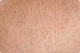 What Is the Best Whipped Shea Butter for Dry Skin in Canada?