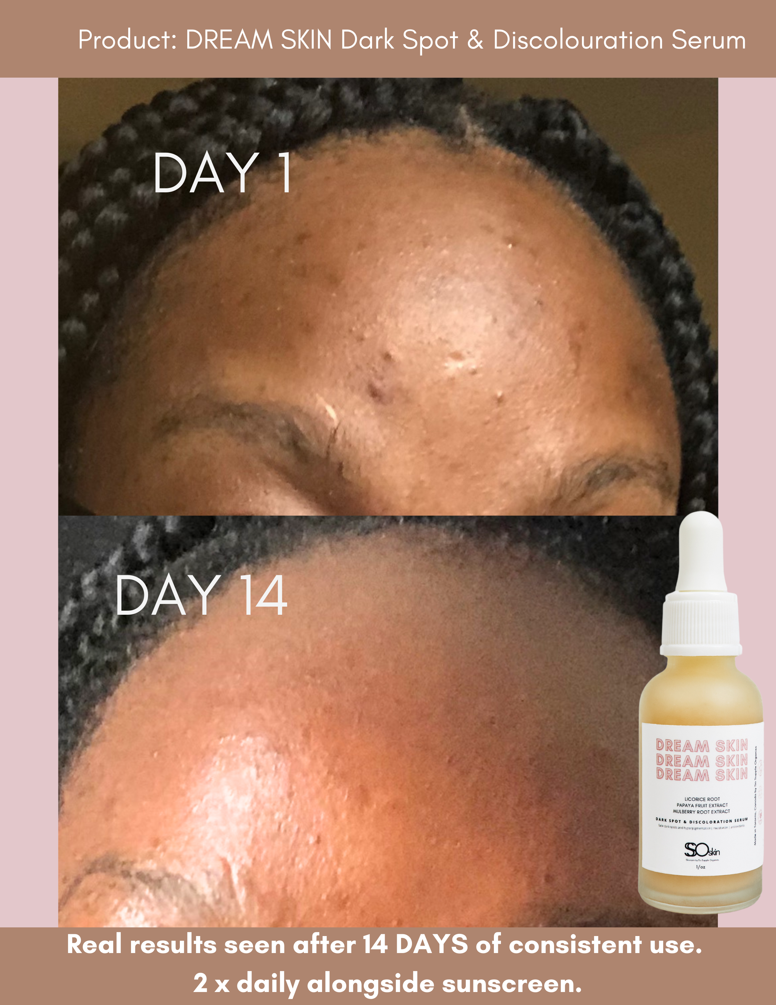 DREAM SKIN Dark Spot &amp; Discoloration Serum