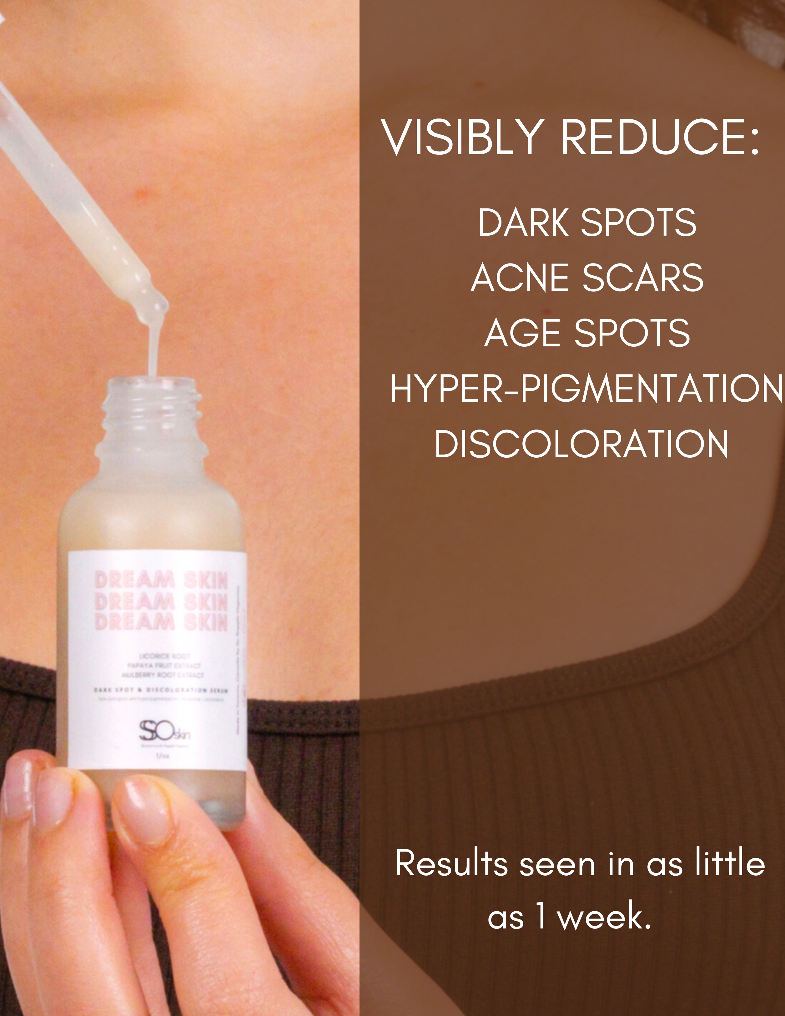 DREAM SKIN Dark Spot &amp; Discoloration Serum